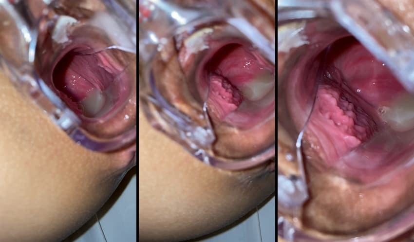 KA25052427_슬랜더_복근_걸레녀_초대남-5_sexkbj