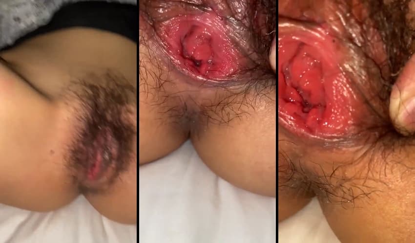 KA25071425_보지털_태우기때리기-2_sexkbj